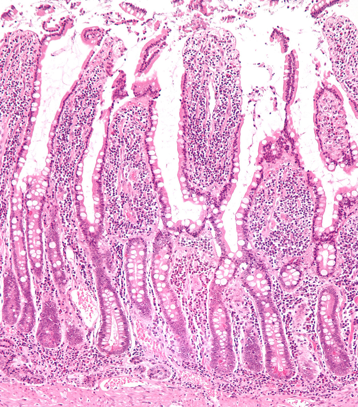 Optimal Gut Health: The Key to Wellness and Vitality