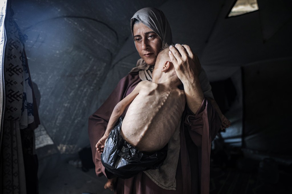 Gaza Expert: Famine is a Slaughter — This is How You Can Help Stop&nbsp;it